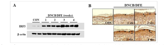 DNCB/DFE로 유도된 아토피피부염 마우스모델의 피부조직에서 IRF3의 발현 양상 확인