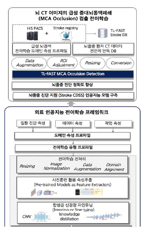 뇌경색 진단 지원 전이학습 구조