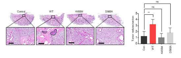 대장암 세포에서 MSK1 kinase에 의한 in vivo 전이 능력 증가 확인