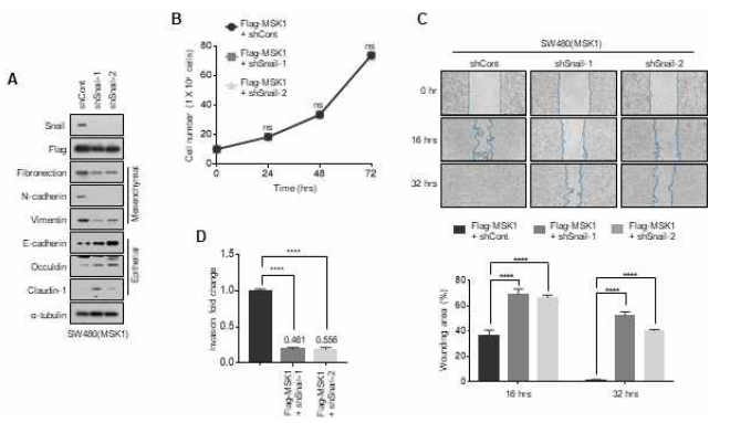 MSK1 kinase에 의한 EMT 유도 및 in vitro 전이 능력증가 과정에서 Snail 단백질의 역할 확인