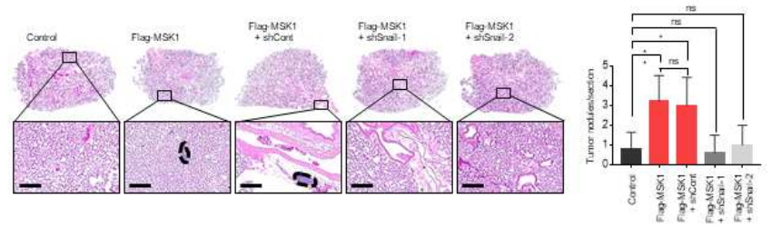 MSK1 kinase에 의한 in vivo 전이 능력 증가 과정에서 Snail 단백질의 역할 확인