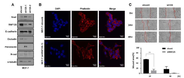 MCF-7 유방암 세포에서 Rnf125의 발현 억제에 의한 EMT 및 migration 능력 증가 확인