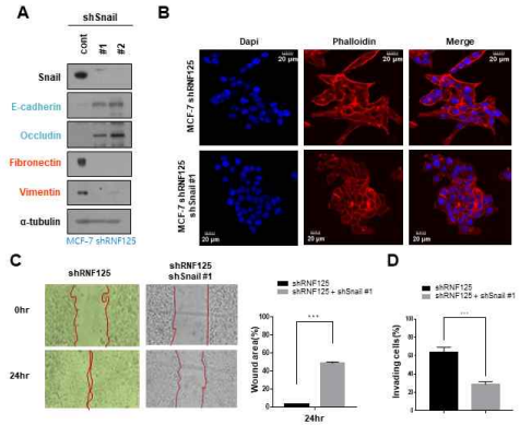 Rnf125의 발현 억제에 의한 in vitro 전이 능력 증가 과정에서 Snail의 역할 확인