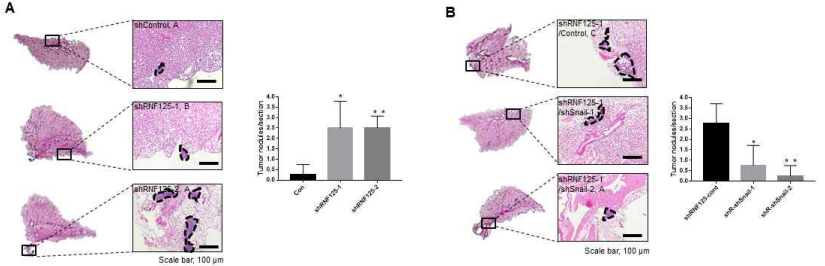 유방암 세포에서 Rnf125의 발현 억제에 의한 in vivo 전이 능력 증가 과정에서 Snail 단백질의 역할 확인