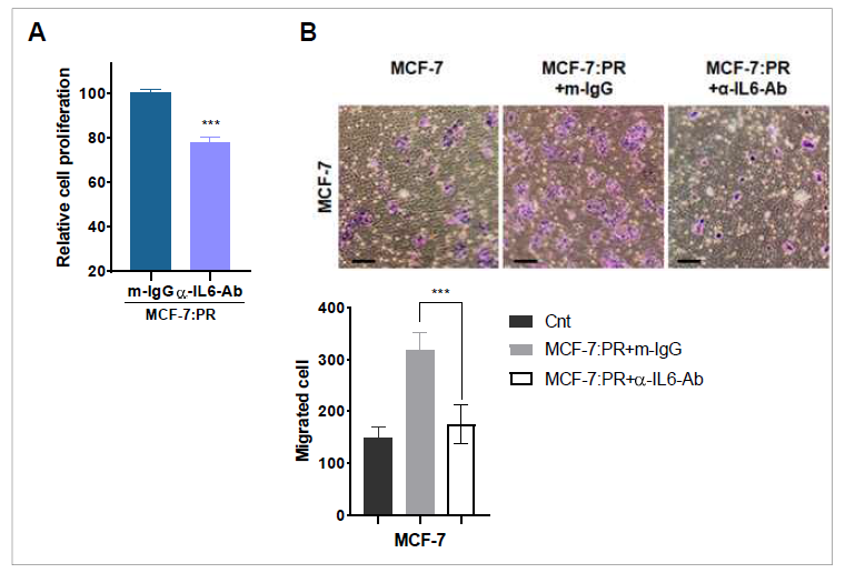 IL6 regulates cell proliferation and migration