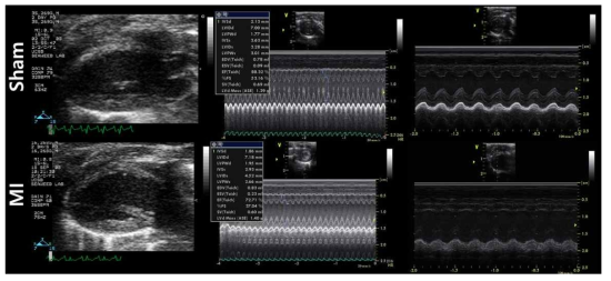 정상 및 MI 모델의 심초음파 분석 결과