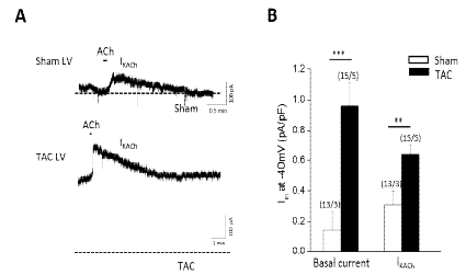 TAC 마우스 심실세포의 constitutive GIRK 활성 증가
