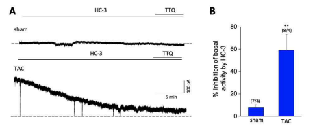 Effects of hemicholinium-3 on constitutive GIRK activity in mice model of heart failure