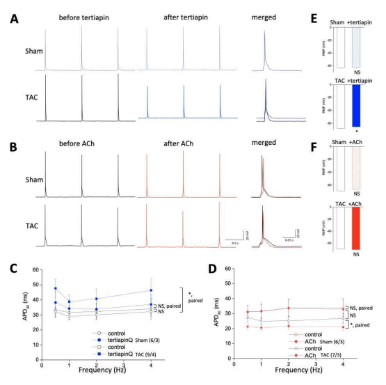 Effects of tertiapin-Q, a specific GIRK channel blocker on the action potentials of ventricular myocytes from sham mice and mice model of heart failure. A-B. representative action potential (AP) trace of ventricular myocytes from sham mice and heart failure model mice induced by TAC before and after tertiapin-Q (A) or ACh (B). C-D. summarized data for APD90 obtained from experiments A (C) or B (D). E-F. summarized data for resting membrane potential (RMP) obtained from experiments A (E) or B (F)