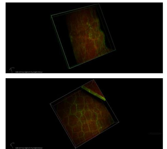 신경섬유(Tuj-1,green)와 Myenteric Plexus (상) 와 Myenteric Plexus의 ganglion 에 감염된 virus signal, (Red)