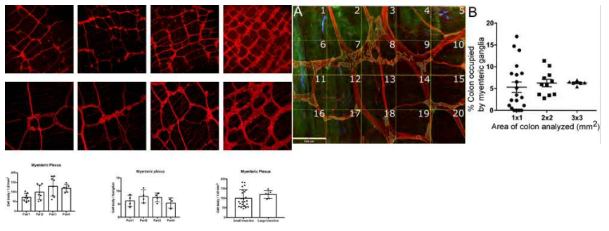 마우스 모델에서 Myenteric Plexus의 신경절 개수와 분포를 정량화하여 분석 가능함