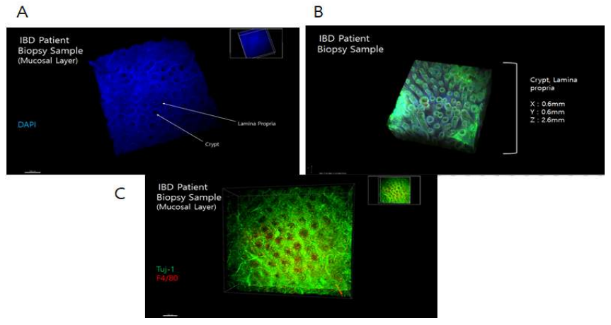 A, 공초점현미경으로 관찰한 인체유래물의 실제 3차원 구조, B, 공초점현미경으로 관찰한 인체유래물의 실제 3차원 구조, C, 염증성장질환환자 인체유래물에서의 점막하층 신경절 구조 확인