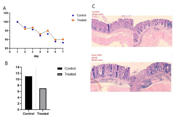 ChAT-cre-Tomato+IL-10 KO mouse에서 Retro-AAV virus 3dq와 CNO에 의한 신경활성화의 장염 억제효과 분석. (A) 신경활서화군과 control 군에서의 체중 변화 (B)장염유도 장길이 변화 (C) 장염유도후 조직학적 변화
