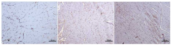 대조군(왼쪽) 저에너지 중주파 자극(가운데) 고에너지 중주파 자극(오른쪽) 염색(MyoD) 비교