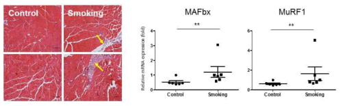 흡연모델에서의 근육 조직학 검사 및 MAFbx와 MuRF1 유전자 발현 양상
