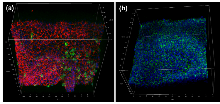 멜라닌세포 부착인자 단백질의 3차원 이미지. (a) Green : melanocyte, Red : E-cadherin, (b) Blue : nucleus, Green : β-catenin, X400