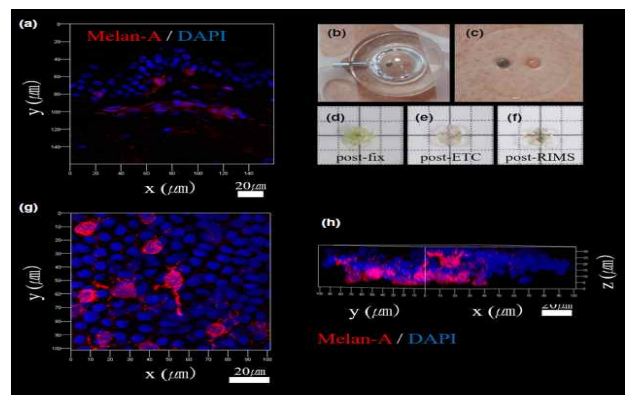 사람 표피의 멜라닌세포 이미지. (a) 80 ㎛ 두께의 절편에서 획득한 멜라닌세포 2D 이미지 (통상적 분석 방법). (b, c) Suction blister 방법. (d-f) 피부 투명화 과정. (g, h) 피부 투명화 과정을 통해 획득한 온전한 형태의 멜라닌세포 3D 이미지 (g : bird’s-eye, h : diagonal view). Red : Melan-A 항체로 표지된 멜라닌세포, Blue : nucleus, ETC : electrophoretic tissue clearing, RIMS : reflective index matching solution