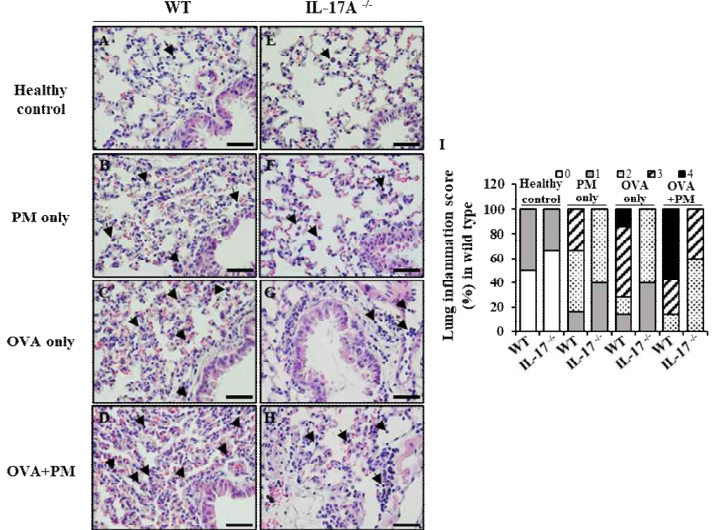 미세먼지 흡입으로 인해 손상된 폐 조직에서 IL-17A 결손으로 인한 염증 세포 침윤 억제