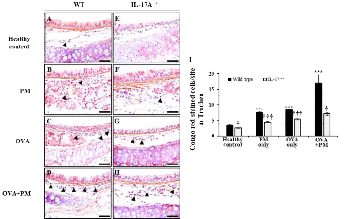 미세먼지 흡입으로 인해 손상된 기관 조직에서 IL-17A 결손으로 인한 염증 세포 및 호산구성 백혈구 침윤 억제(*: 대조군과 비교하여 증가, †: Wild type과 비교하여 감소 †: p<0.05, ***,†††: p<0.005)