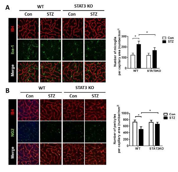미세교세포 특이적 STAT3 유전자 결손(STAT3 KO) 마우스에 당뇨(STZ)를 유발함. (A) 정상 마우스 망막의 미세교세 포(Iba-1 양성) 숫자가 당뇨에 의 해 증가하지만 미세교세포활성화를 억제하면, 미세교세포 숫적 증가가 억제됨. (B) 정상 마우스 망막의 혈관주변세포 세포 숫자가 당뇨에 의해 감소하지만 미세교세포활성화를 억제하면, 혈관주변세포 감소가 억제됨