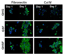 hMSC가 캡슐화된 하이드로겔에서 피브로넥틴과 콜라겐 IV 형광염색결과