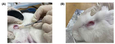 토끼 망막색소상피세포 변성 모델 구축 수술 장면 (A) NaIO3 (Sodium iodate)를 100mg/kg 농도로 유리체 내 주사 (B) NaIO3 주입 2주 후 상태