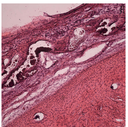 토끼 망막색소상피세포 변성 모델 H&E staining 이미지