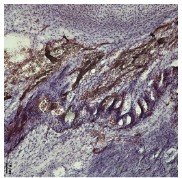 토끼 망막색소상피세포 변성 모델 ED-1 staining 이미지