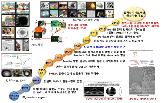 안질환 치료 변천사