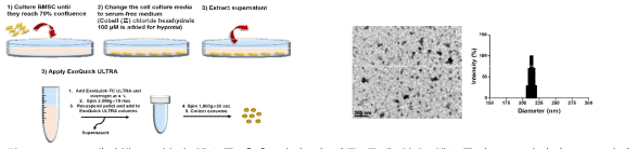 BMSC 배양액으로부터 엑소좀 추출 방법 및 이를 통해 얻은 엑소좀의 TEM사진과 DLS 결과