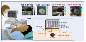 진단 및 수술용 초음파-핵의학 휴대용 융합 영상기기 개념도 및 영상 예시