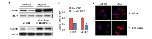 TonEBP 결손에 의한 전이촉진 인자 및 표현형 감소 (a) 암미세환경 모방조건(저산소환경 및 암세포 공생배양)에서 단핵구 세포주(THP-1)의 TonEBP 발현 증가 (b) TonEBP 발현이 감소된 단핵구에서 CCR2 및 VEGFA 발현 감소 (c) TonEBP 발현이 감소된 단핵구에서 CCL2에 대한 주향성 (chemotaxis) 감소