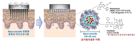 양친성 블록공중합체를 이용한 지용성 약물 탑재 나노미셀 방출 마이크로니들 모식도