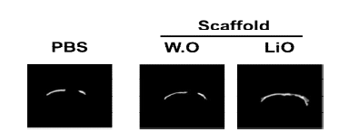 Hydrogel-BCP 복합체의 골 형성능 실험 micro-CT 이미지.