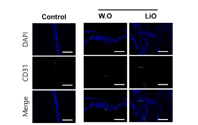 Hydrogel-BCP 복합체의 골 형성능 실험 결과;DAPI, CD31 염색.