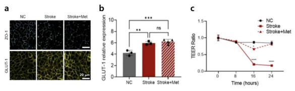 (a) Immunofluorescence images of blood-brain barrier models in normal condition (NC), stroke condition (Stroke), and stroke condition treated with Metformin (Stroke+Met). (b) GLUT1 protein expression of BBB models in each condition. (c) Measured TEER value of BBB models in each condition