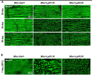 근육조직에서 LDL receptor 감소에 따른 밑토콘드리아 감소가 노화의 원인으로 확인