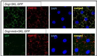 DYRK1A/minibrain 과발현에 따른 퍼록시좀 동태 변화