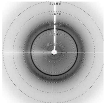 X-ray diffraction