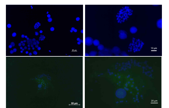 DAPI로 염색된 염색체 사진(위)과 Q-FISH 시도한 결과(아래)