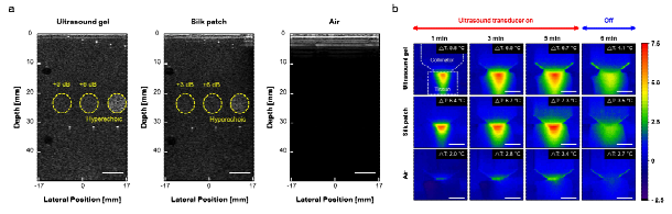 패치 형태의 초음파 매칭 패드를 활용한 어플리케이션. a) 초음파 이미징 성능 비교, b) 초음파를 이용한 조직 내 열전달 성능 비교