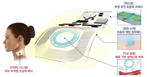 유연 초음파 무선 패치 시스템 모식도