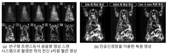 반구형 트랜스듀서를 통한 광음향 영상 스캔 시스템 영상 결과