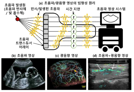 (a) 초음파/광음향 영상재구성에 사용되는 빔형성 다이어그램. (b) 초음파 태아 단면 영상 (c) 사람 가슴 혈관 영상. (d) 초음파/광음향 단면 영상. 초음파는 흑백, 광음향은 색상 영상으로 겹쳐져서 표현됨