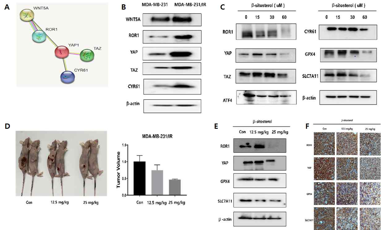 In vivo 실험을 통한 방사선 내성 유방암세포에서의 β-Sitosterol 항암 효능 연구