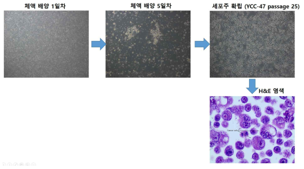 체액 내 암세포 배양을 통한 세포주/오가노이드 구축을 위한 최적화 프로토콜 확립