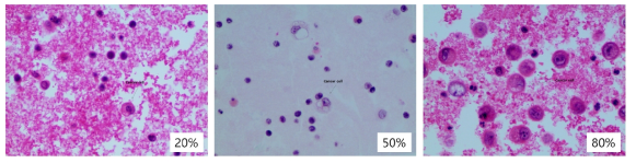 cell block으로 제작한 뒤 H&E 염색 후 cellularity(%) 확인