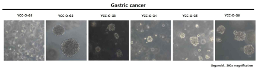 구축된 위암 환자 체액 유래 오가노이드