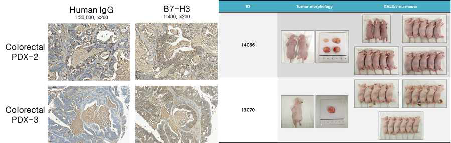 B7H3-positive Colorectal cancer PDX의 IHC 결과와 PDX 마우스 모델 복원