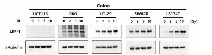 대장암 세포주에서 LRP-1의 발현 및 방사선에 의한 발현 변화 평가